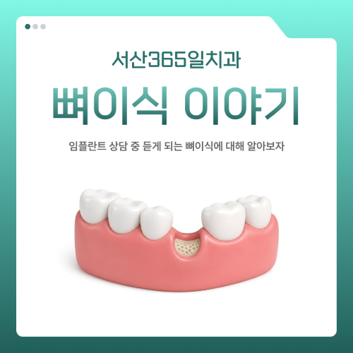 서산치과 뼈이식이야기